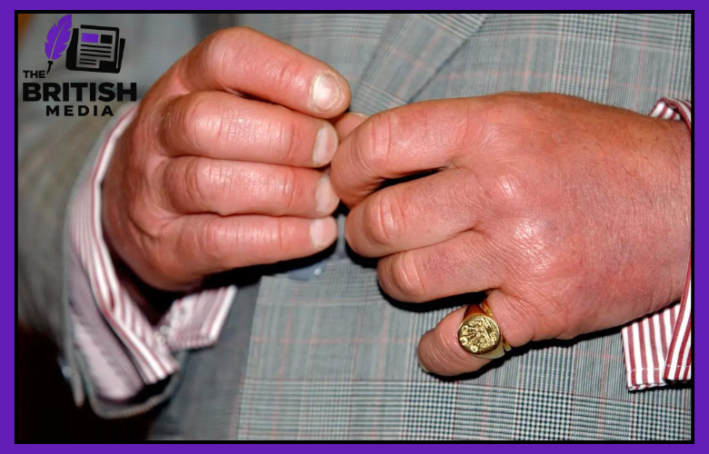 King Charles Fingers Why His Hands Look Swollen and What We Know
